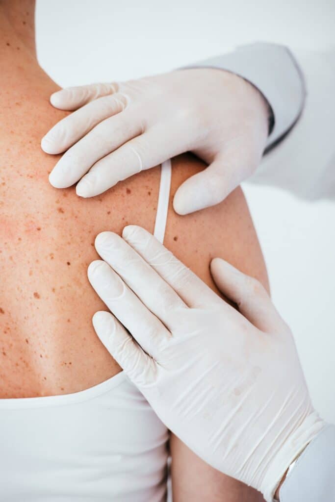 cropped view of dermatologist in latex gloves examining woman with melanoma on back  isolated on
